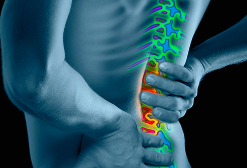 image of lower back pain