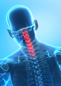 neck-pain-cervical-spine