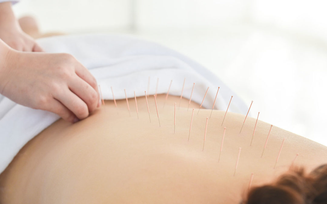 The Many Uses of Accupuncture