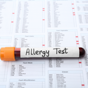 allergy test