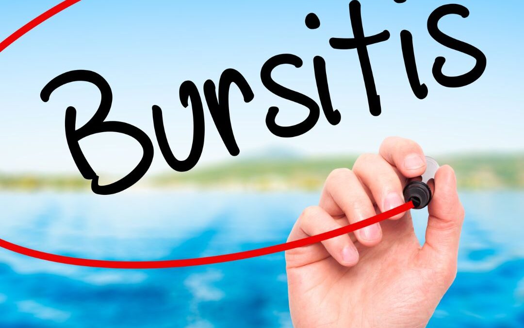 Bursitis: Easy Ways You Can Find Relief Now
