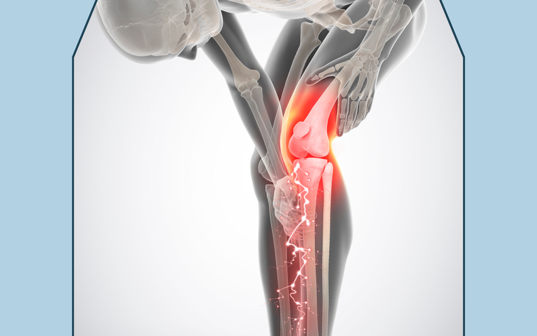 referred pain shooting down a leg