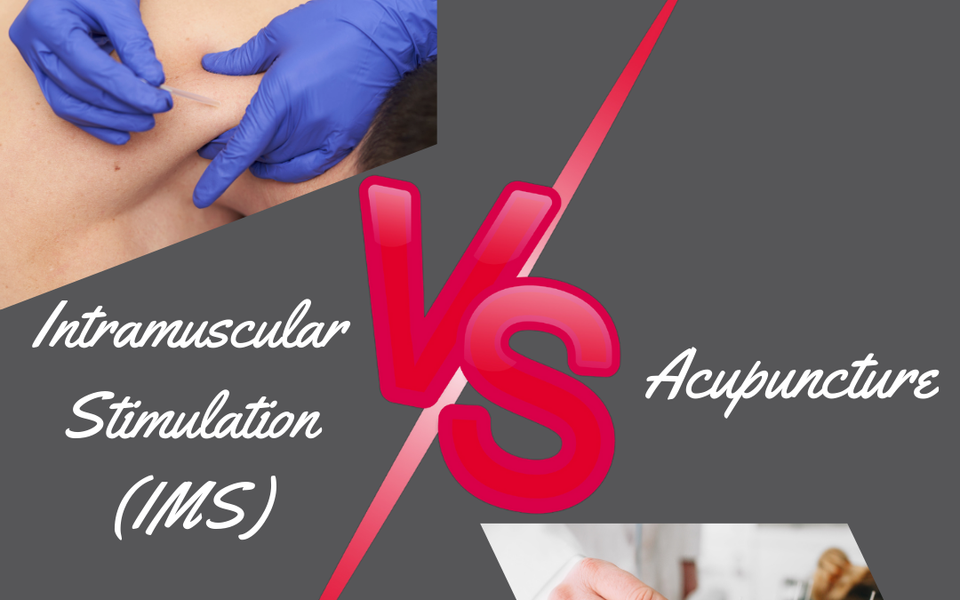 How to Know the Difference Between IMS and Acupuncture.